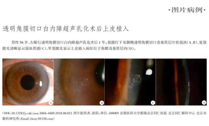 /officialwebsite/images/2024/04/08/18604a3f7410c2d81b6142d8322950ab.png 微信截图_20240408155753.png