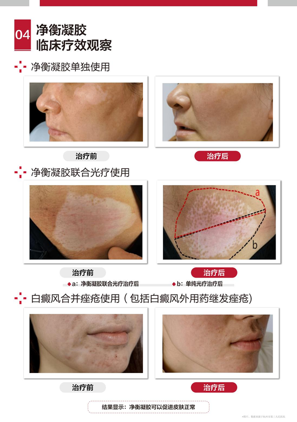 /officialwebsite/images/2025/07/02/5092caf4ff6a6390984b6772ba0b5232.png 图片8.png